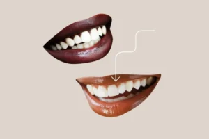سونامی کامپوزیت‌های ارزان‌قیمت؛ چرا باید به این ارزانی عجیب شک کرد؟